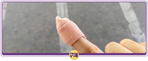 Cuts and Scrapes Treatment Clinic Near Me in Rockville, MD Cuts and Scrapes Treatment Clinic Near Me in Rockville, MD