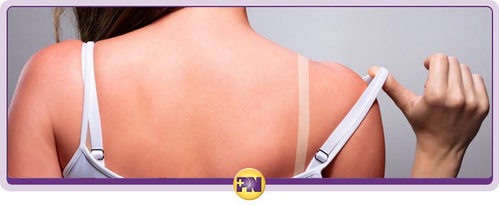 Sunburn Treatment Clinic Near Me in Rockville, MD Sunburn Treatment Clinic Near Me in Rockville, MD