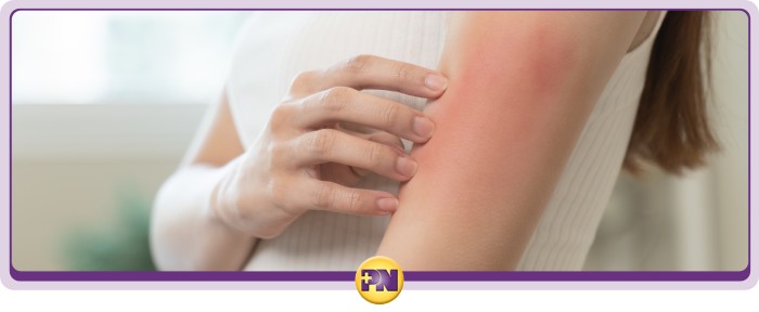 Urgent Care for Allergy Treatment Near Me in Rockville MD Urgent Care for Allergy Treatment Near Me in Rockville MD