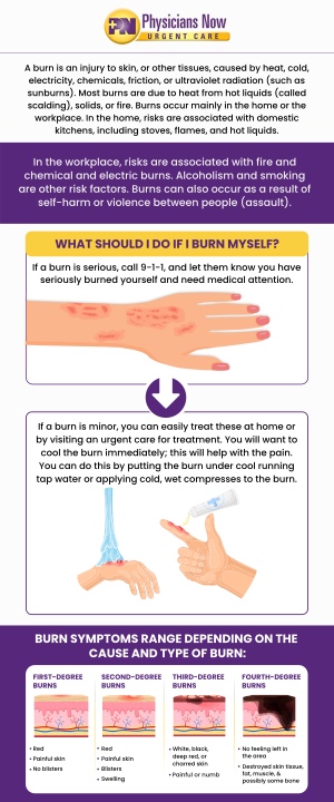 Minor burns can still cause significant damage, it is best to get checked out by your medical provider to make sure no further damage under the skin was caused, or that an infection may occur due to the significant nature of the burn. At Physicians Now Urgent Care and Walk-In Clinic, our doctors and medical professionals are experienced in treating various kinds of burns. Contact us today for more information or schedule an appointment online. We are conveniently located at 15215 Shady Grove Road, Suite 100, Rockville, MD 20850.