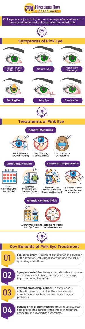 Pink eye is an inflammation of the transparent membrane that lines the eyelid and eyeball. Symptoms of pink eye can vary but typically include redness or swelling of the white of the eye. Although pink eye is a relatively minor illness, it does not feel that way when you are in the thick of it! If you are looking for fast and effective relief from pink eye, our experienced doctors at Physicians Now Urgent Care and Walk-In Clinic can provide you with the help you need! Contact us for more information. Our clinic is located at 15215 Shady Grove Road, Suite 100, Rockville MD 20850. Pink eye is an inflammation of the transparent membrane that lines the eyelid and eyeball. Symptoms of pink eye can vary but typically include redness or swelling of the white of the eye. Although pink eye is a relatively minor illness, it does not feel that way when you are in the thick of it! If you are looking for fast and effective relief from pink eye, our experienced doctors at Physicians Now Urgent Care and Walk-In Clinic can provide you with the help you need! Contact us for more information. Our clinic is located at 15215 Shady Grove Road, Suite 100, Rockville MD 20850.