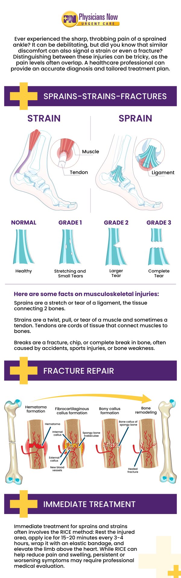 If you experience a sprain or strain, it is best to have the injury examined by a medical professional. Get immediate care from the experience and caring doctors at Physicians Now Urgent Care and Walk-In Clinic. We also provide walk-in services. Contact us today for more information or schedule an appointment online. We are conveniently located at 15215 Shady Grove Road, Suite 100, Rockville, MD 20850. If you experience a sprain or strain, it is best to have the injury examined by a medical professional. Get immediate care from the experience and caring doctors at Physicians Now Urgent Care and Walk-In Clinic. We also provide walk-in services. Contact us today for more information or schedule an appointment online. We are conveniently located at 15215 Shady Grove Road, Suite 100, Rockville, MD 20850.