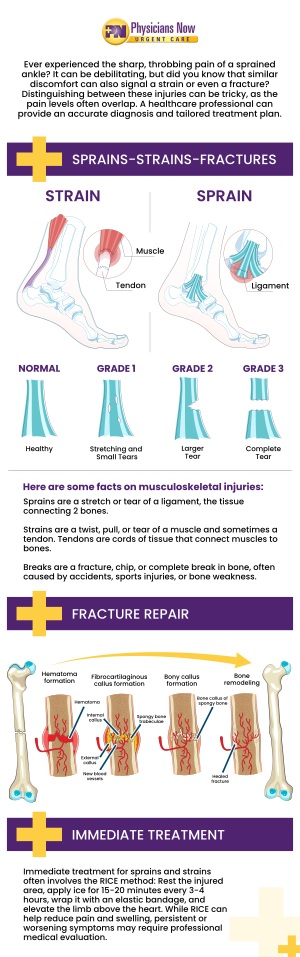 If you experience a sprain or strain, it is best to have the injury examined by a medical professional. Get immediate care from the experience and caring doctors at Physicians Now Urgent Care and Walk-In Clinic. We also provide walk-in services. Contact us today for more information or schedule an appointment online. We are conveniently located at 15215 Shady Grove Road, Suite 100, Rockville, MD 20850. If you experience a sprain or strain, it is best to have the injury examined by a medical professional. Get immediate care from the experience and caring doctors at Physicians Now Urgent Care and Walk-In Clinic. We also provide walk-in services. Contact us today for more information or schedule an appointment online. We are conveniently located at 15215 Shady Grove Road, Suite 100, Rockville, MD 20850.