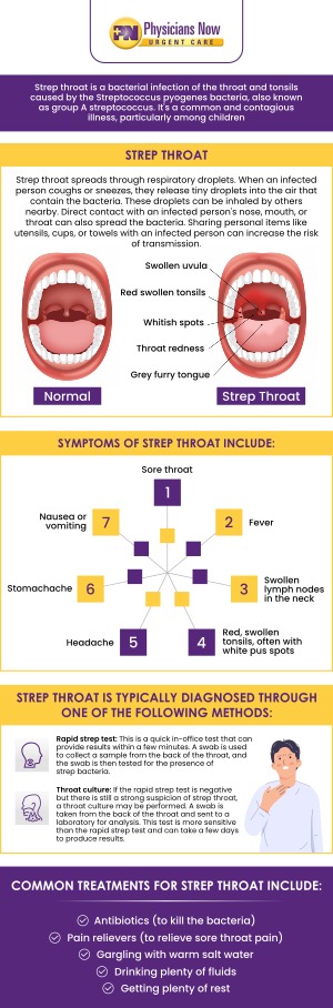 Strep throat is a bacterial infection that can make your throat feel sore and scratchy. Strep throat can be uncomfortable and sometimes even painful. Visit Physicians Now Urgent Care and Walk-In Clinic today to get diagnosed and treated for your strep throat symptoms, so you do not have to live in pain much longer. For more information, contact us or schedule an appointment. We are open 5 days a week. We are conveniently located at 15215 Shady Grove Road, Suite 100, Rockville, MD 20850 Strep throat is a bacterial infection that can make your throat feel sore and scratchy. Strep throat can be uncomfortable and sometimes even painful. Visit Physicians Now Urgent Care and Walk-In Clinic today to get diagnosed and treated for your strep throat symptoms, so you do not have to live in pain much longer. For more information, contact us or schedule an appointment. We are open 5 days a week. We are conveniently located at 15215 Shady Grove Road, Suite 100, Rockville, MD 20850